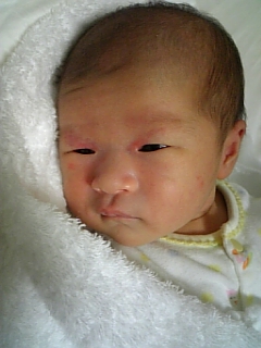 周り の 赤い 目 新生児